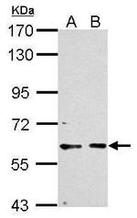 PCTAIRE1 Antibody in Western Blot (WB)