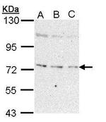 NEK8 Antibody in Western Blot (WB)