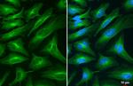 TUBA1A Antibody in Immunocytochemistry (ICC/IF)