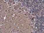 TUBA1A Antibody in Immunohistochemistry (Paraffin) (IHC (P))