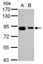 EPS8L2 Antibody in Western Blot (WB)