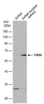 TIP60 Antibody in Western Blot (WB)