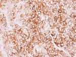 Creatine Kinase MT Antibody in Immunohistochemistry (Paraffin) (IHC (P))