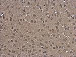 HSPA4 Antibody in Immunohistochemistry (Paraffin) (IHC (P))