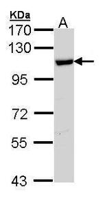 HSPA4 Antibody in Western Blot (WB)