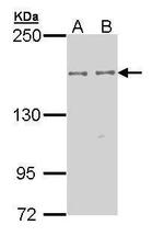 EPB41L2 Antibody in Western Blot (WB)