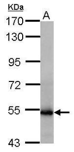 GluD1/GluD2 Antibody in Western Blot (WB)