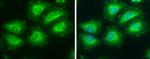 ATP Citrate Lyase Antibody in Immunocytochemistry (ICC/IF)