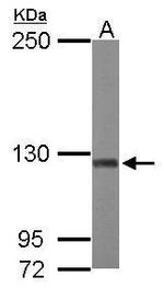 ATP Citrate Lyase Antibody in Western Blot (WB)