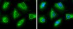 ATP Citrate Lyase Antibody in Immunocytochemistry (ICC/IF)