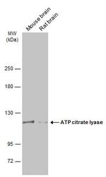 ATP Citrate Lyase Antibody in Western Blot (WB)