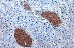 ATP Citrate Lyase Antibody in Immunohistochemistry (Paraffin) (IHC (P))