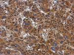 ATP Citrate Lyase Antibody in Immunohistochemistry (Paraffin) (IHC (P))