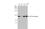 ATP Citrate Lyase Antibody in Western Blot (WB)