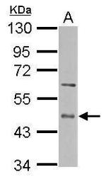 ENTPD5 Antibody in Western Blot (WB)