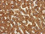 ACSL1 Antibody in Immunohistochemistry (Paraffin) (IHC (P))