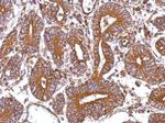 CTAGE5 Antibody in Immunohistochemistry (Paraffin) (IHC (P))