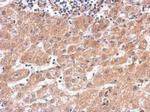 alanyl-tRNA Synthetase Antibody in Immunohistochemistry (Paraffin) (IHC (P))