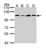 alanyl-tRNA Synthetase Antibody in Western Blot (WB)