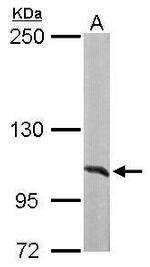 alanyl-tRNA Synthetase Antibody in Western Blot (WB)