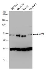 AMPD2 Antibody in Western Blot (WB)