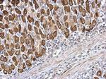 CDS1 Antibody in Immunohistochemistry (Paraffin) (IHC (P))