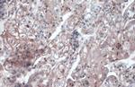 CD105 Antibody in Immunohistochemistry (Paraffin) (IHC (P))