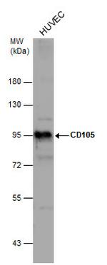 CD105 Antibody in Western Blot (WB)