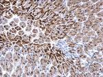 GSTP1 Antibody in Immunohistochemistry (Paraffin) (IHC (P))