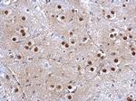 GSTP1 Antibody in Immunohistochemistry (Paraffin) (IHC (P))