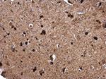 GSTP1 Antibody in Immunohistochemistry (Paraffin) (IHC (P))