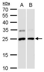 GSTP1 Antibody in Western Blot (WB)