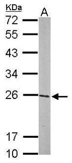 GSTP1 Antibody in Western Blot (WB)