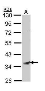 BST-1 Antibody in Western Blot (WB)