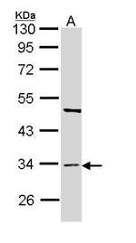 BST-1 Antibody in Western Blot (WB)