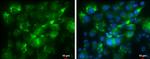 COL1A1 Antibody in Immunocytochemistry (ICC/IF)