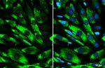 COL1A1 Antibody in Immunocytochemistry (ICC/IF)