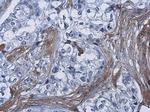 COL1A1 Antibody in Immunohistochemistry (Paraffin) (IHC (P))