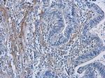 COL1A1 Antibody in Immunohistochemistry (Paraffin) (IHC (P))