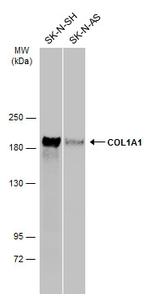 COL1A1 Antibody in Western Blot (WB)