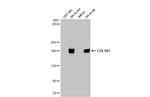 COL1A1 Antibody in Western Blot (WB)