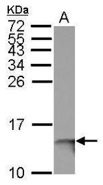 beta-2 Microglobulin Antibody in Western Blot (WB)