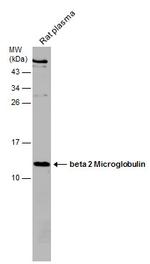 beta-2 Microglobulin Antibody in Western Blot (WB)