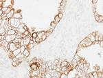 Cytokeratin 19 Antibody in Immunohistochemistry (Paraffin) (IHC (P))