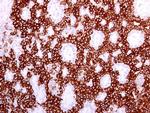 Cytokeratin 19 Antibody in Immunohistochemistry (Paraffin) (IHC (P))