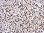 FLI1 Antibody in Immunohistochemistry (Paraffin) (IHC (P))