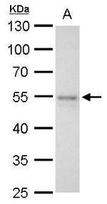 FLI1 Antibody in Western Blot (WB)