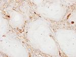 Ferritin Light Chain Antibody in Immunohistochemistry (Paraffin) (IHC (P))