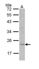 Ferritin Light Chain Antibody in Western Blot (WB)