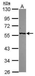 GPT Antibody in Western Blot (WB)